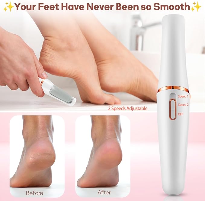 Electric Foot Callus Remover, Callus Remover for Feet Rechargeable Portable Pedicure Tool Kit, Smooth Pedicure Wand for Feet Care, Removes Dry Hard & Dead Skin Ideal Gift (White)