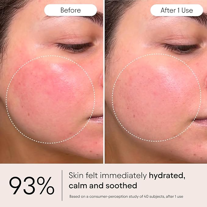 Alpyn Super Peptide & Ghostberry Moisturizer for Eczema, Barrier & Wrinkle Repair | Calm & Soothe Against Redness & Irritation (0.5 Oz)