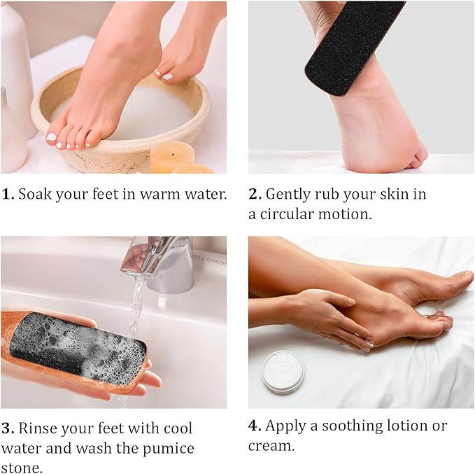 Foot File with Handle Pumice Stone for Dry Dead Skin - Callus Remover for Feet Double-Sided Foot File for Callus, Cracked Heels, Dead, and Dry Skin Removal
