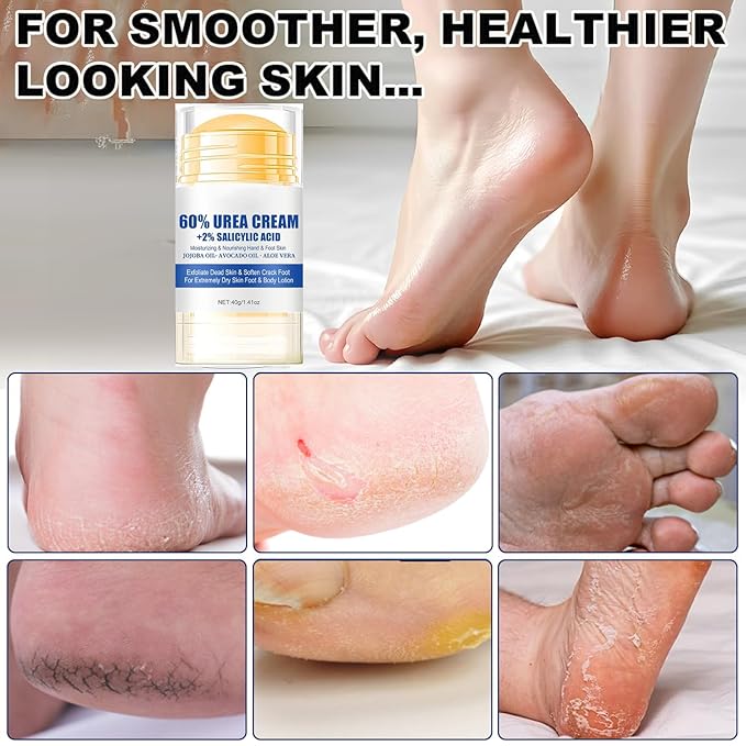 60% Urea Foot Cream Care Stick for Feet Plus 2% Salicylic Acid, 2026 New Urea Heel Stick Cream 60 Percent Foot Callus Remover Cream for Feet Maximum Strength, for Dry Cracked Heels, Hands, Knees (3)