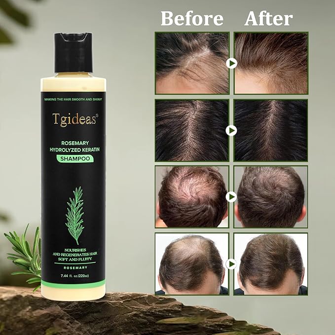 Tgideas Organic Rosemary Hair Growth Shampoo for Women and Men-Natural Thickening & Strengthening Shampoo with Hydrolyzed Keratin for Thinning Hair & Hair Loss 7.4 fl.oz