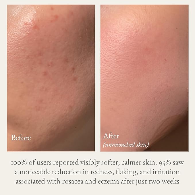 Goat Milk Lotion for Dry, Sensitive Skin – Natural Body Moisturizer for Face, Hands & Body – Hydrating Non-Greasy Cream – Handmade in USA with Clean Ingredients (16oz, French Lavender)