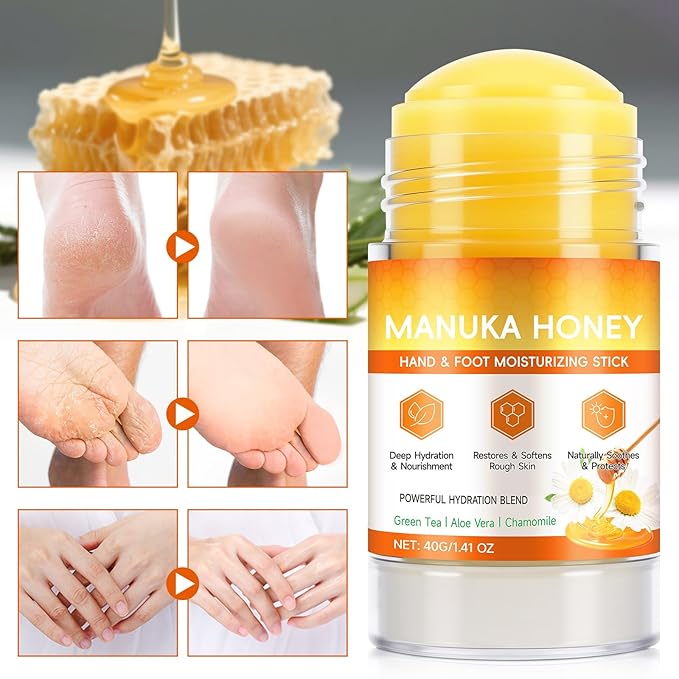 Manuka Honey Cracked Heel Treatment Balm Stick, Dry & Cracked Foot Repair for Intensively & Deeply Moisturizing & Hydrating, Soothing, with Shea Butter, Chamomile|1.41 Oz/40 G