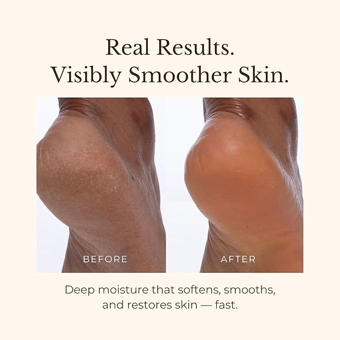 Juara Candlenut Body Cream for Dry Skin - Moisturizing Body Lotion with Natural Oils & Butters - Hydrating Daily Moisturizer - 7.5 oz