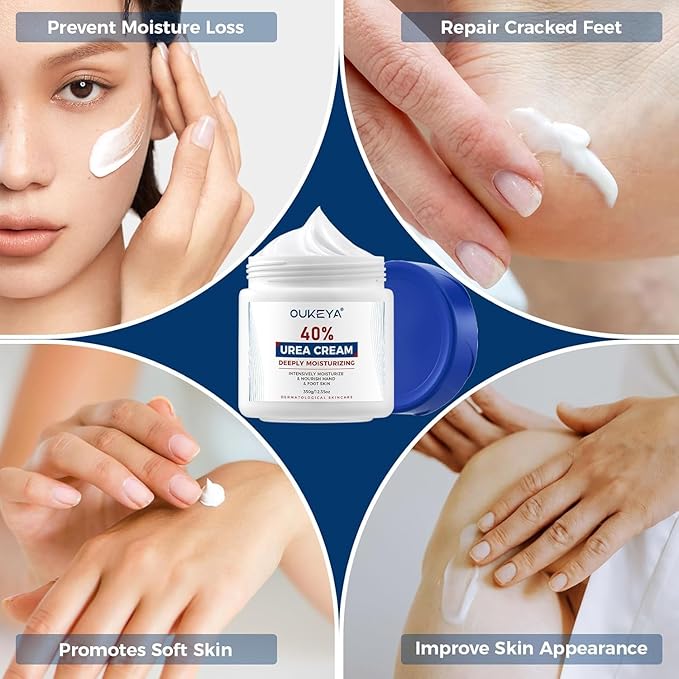 OUKEYA Urea Cream 40 Percent, Foot & Hand Cream for Dry Cracked, Urea Lotion for Feet Maximum Strength(12.35Oz X 4 Packs)