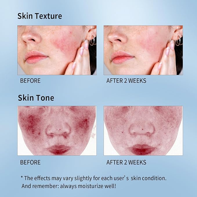 Soothing Face Sheet Mask (10 Sheets), Anti-Aging, Detoxifying & Moisturizing Face Mask for Sensitive Skin with Centella Asiatica, Vitamin B5, Glass Skin Face Mask for after Microneedling