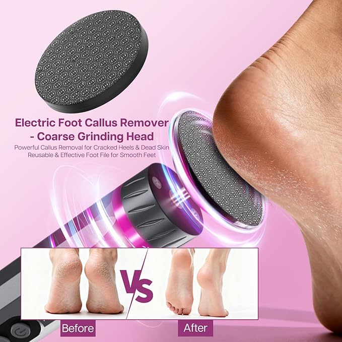 Professional Electric Foot Callus Remover, 9-Speed Cordless Foot File with Reusable Nano Glass Heads & Sandpaper for Dead Skin Removal and Smooth Feet