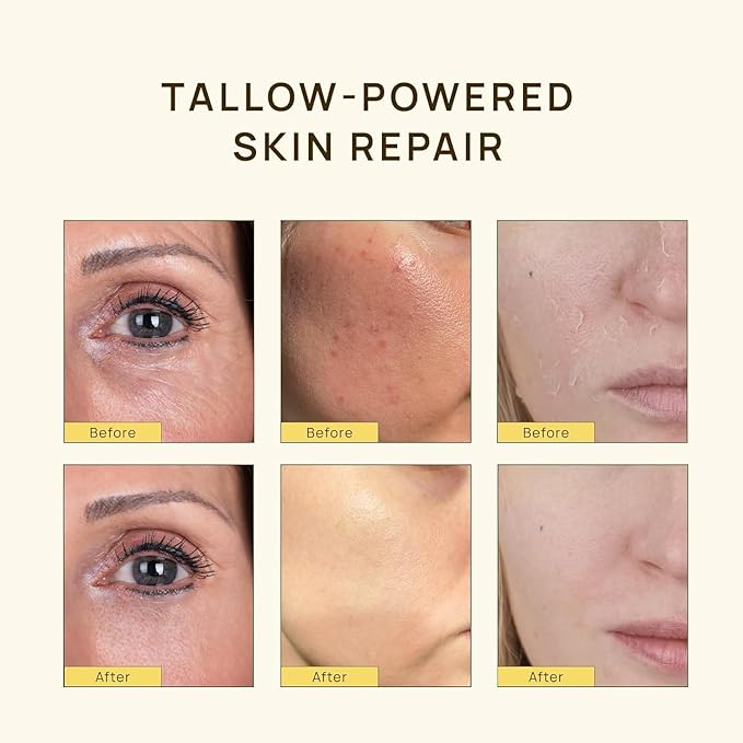 Grass-Fed Beef Tallow for Skin: Organic Whipped Tallow and Honey Balm - Face Moisturizer & Body Cream - Deep Hydrating & Nourishing - Raw Wild Honey, Beeswax, & Vitamin E, 2.3 Oz