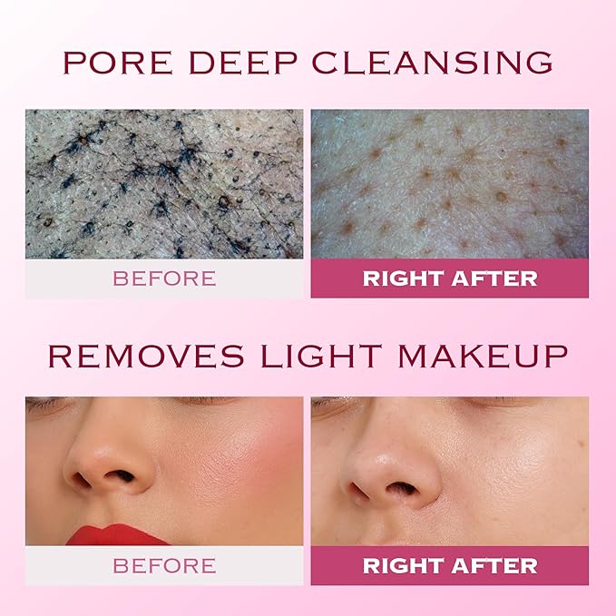 VERY BERRY Pore Deep Cleansing Foam | Berry Complex+Micro Biome for Moisture & Healthy Glow | Gentle Exfoliating Face Scrub for Bumpy Skin | Pore Cleanser | 100g/ 3ea