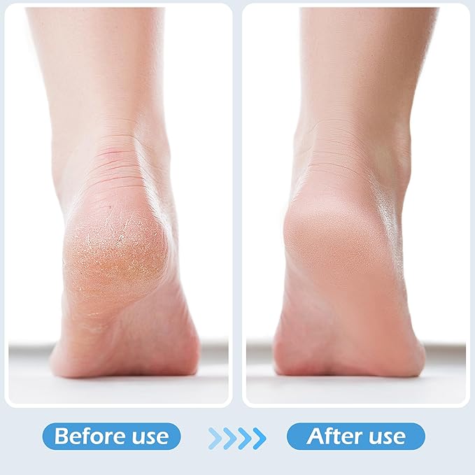 2 Pcs 4 in 1 Foot Brush for Use in Shower with Pumice Stone, Foot Rasp and Sandpaper, Foot Scrubber Brush for Feet, Dead Skin Remover for Foot Care