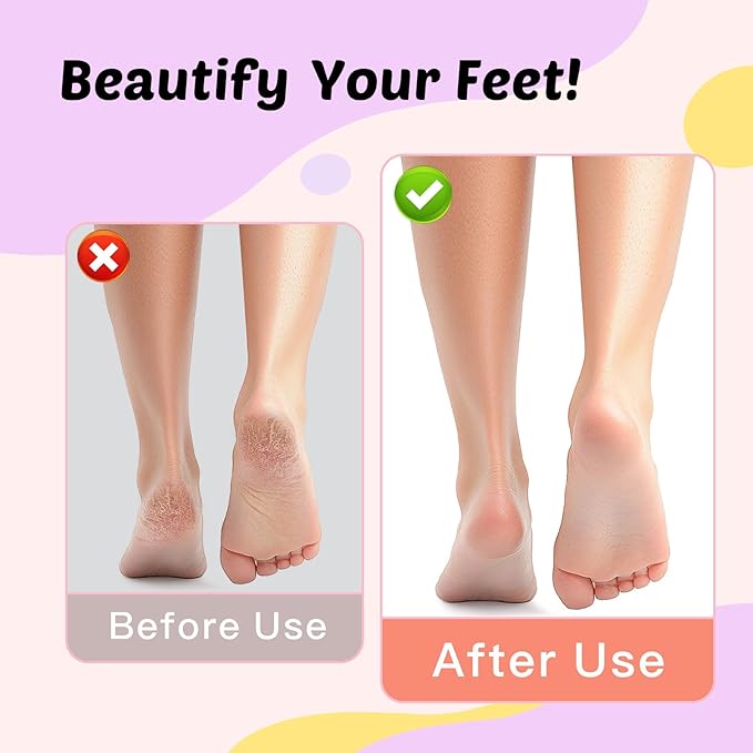 Electric Foot Callus Remover & Nail File - Electric Callus Remover for Feet, 9 Adjustable Speeds, 1800mAh Rechargeable, Portable Aluminum Body w/Type-C Charging for Home & Travel (Purple)