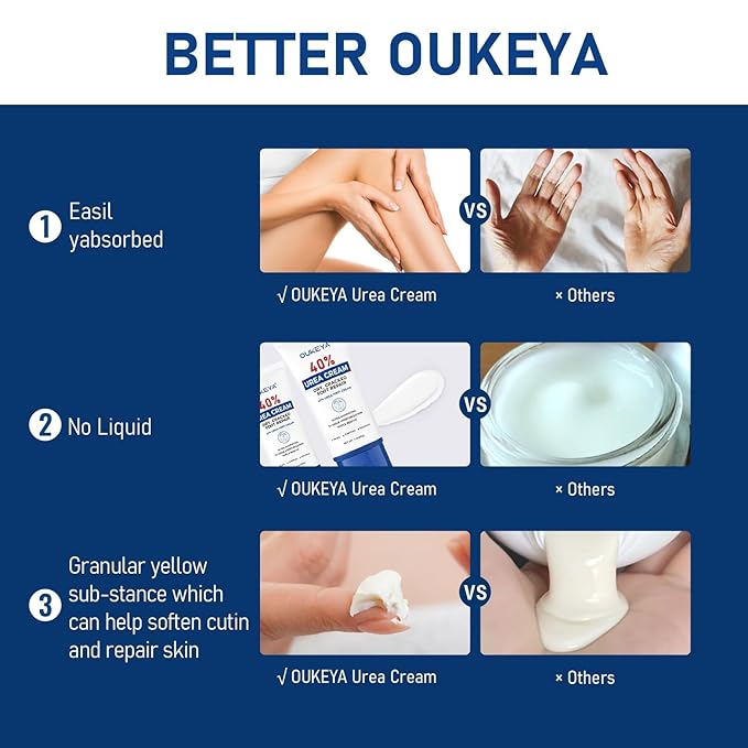 OUKEYA Urea Cream 40 Percent Tube 3 Oz, Foot & Hand Cream for Dry Cracked,40 per Urea Lotion for Feet Maximum Strength, 2 Pack