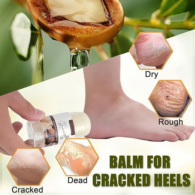 Shea Butter Hydrating Foot Cream, Coconut Nail Softening Hand and Foot Cream Balm Stick, Gentle Soften Heel Balm That Improve Dry Skin for Men Daily Skin Care, 1.41 Oz 1Pc