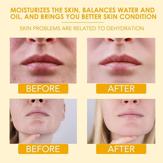 Beef Tallow for Skin, Beef Tallow for Face, Hydrating Tallow Balm with Raw Honey and Beeswax, Grass-Fed Beef Tallow & Raw Wild Honey Blend, Body & Face Moisturizer, Natural Formula, Light Scent