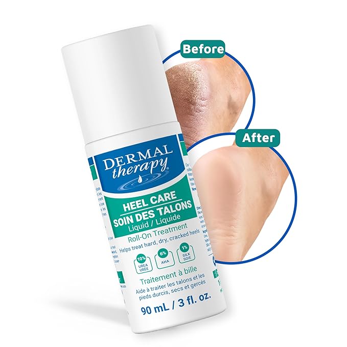 Dermal Therapy Heel Care Liquid Roll-On – Intensive Moisturizing & Repair for Cracked Heels, Dry & Rough Skin – Fast-Absorbing, Mess-Free Application – Hydrating Foot Care Treatment