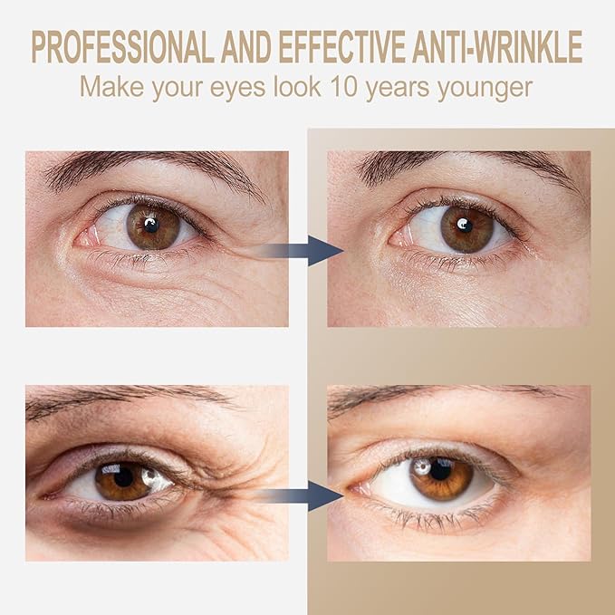 Temporary Instant eye Tightening cream, Quickly Reduces eye bags and dark circles, daily anti-aging,quickly repairs wrinkles,reduces fine lines,contains hyaluronic acid retinol-Locks in Moisture-B1BB