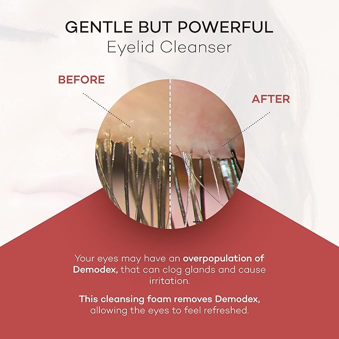 Zocular ZocuFoam Eyelid Cleanser - Foaming Eyelid Scrub - Natural pH Balanced Solution - 1.7 FL OZ (50mL)