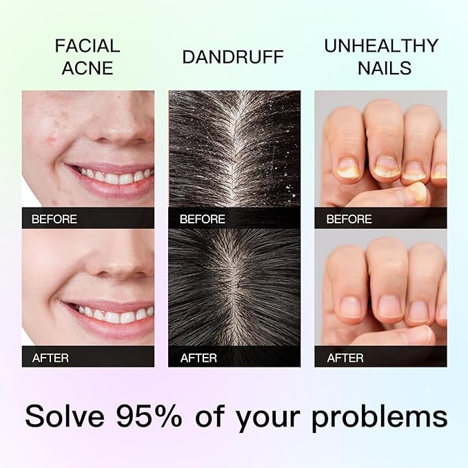 Peppermint Essential Oil Blend, Mint Oil, Essential Oils Organic, Hair Growth & Scalp Care, Essential Oils for Diffusers for Home 10ML