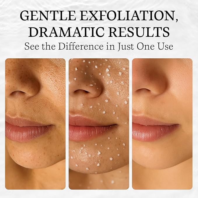 Vivo Per Lei Facial Peeling Gel - Helps Address Dead Skin Buildup - Gentle Exfoliating Gel for Rough, Dry, Sensitive or Mature Skin - Face and Body Scrub - Non Abrasive - 4.05 Fl. Oz. - Pack of 3