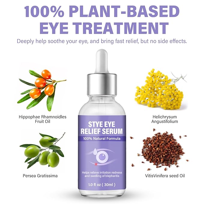 Stye Eye Treatment, Eye Reflief Serum for Styes and Chalazions, Natural & Non-Irritating, Fast-Acting Soothing and Restores Healthier Skin, 30ml