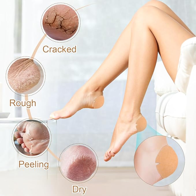 20PCS Patented Cracked Heel Treatment Patches, Cracked Heel Repair Bandage (100mm x 100mm)