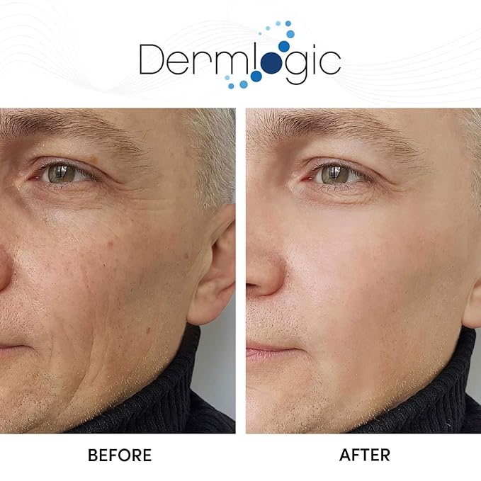 Glycolic Cream 15% - Natural Anti Aging Exfoliator to Smooth Away Fine Lines & Wrinkles & Improve a Dull Looking Complexion. Includes A.H.A & Green Tea Moisturizer for Face & Body.