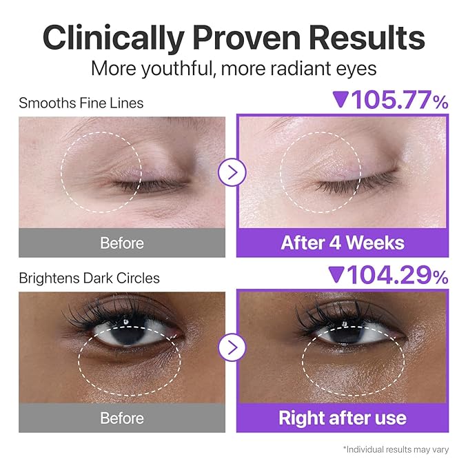 numbuzin No.9 NAD+ Retinol Eye Cream, Depuffing & Firming Eye Serum for Dark Circles, Wrinkles & Fine Lines, Peptides & Niacinamide for Glow & Undereye Radiance, Stocking Stuffers 0.33 fl oz