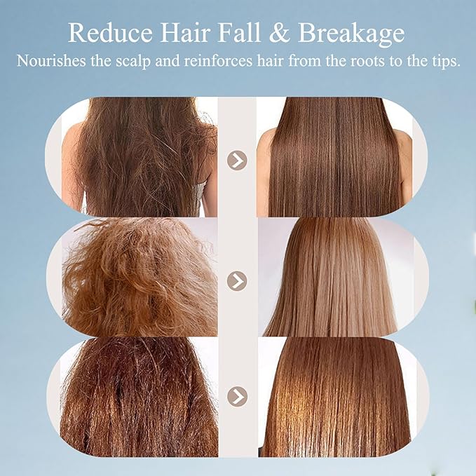 Trichology Shampoo | Anti-Hair Fall & Less Shedding & Volumizing Shampoo | Biotin, Arginine & Oleanolic Acid Strengthens Roots Promotes Hair Growth Oil Control & Scalp Nourishment 300ML (1PCS)