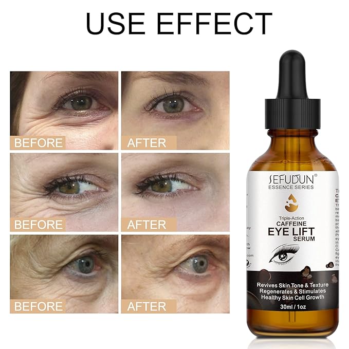Caffeine Eye Serum, Eye Serum Anti Aging Wrinkles Effectively Fades Dark Circles, Eye Bags, Helping to Minimize Wrinkles and Fine Lines, Eliminate Puffiness, with EGCG, Vitamin C Under Eye Serum 30ml