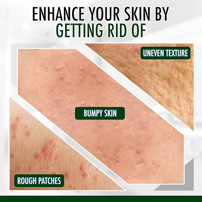 GLY MIRACLE Moisturizing Body Cream Lotion, 12 ounce - Non-Greasy Skin Humectant for Extremely Dry Skin, Hands, Body, and Feet, Fragrance-Free with Pure Glycerin for Nourishing Hydration.