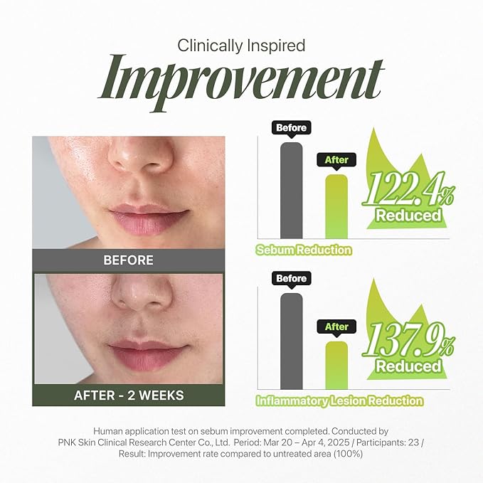 Trouble Patch Mask – Full-Face Acne & Sebum Control Sheet Mask with Tea Tree Biome, Visible Sebum Lift Results, Korean Skincare for Oily & Acne-Prone Skin | Stocking Stuffer Gift | 20ml x 4