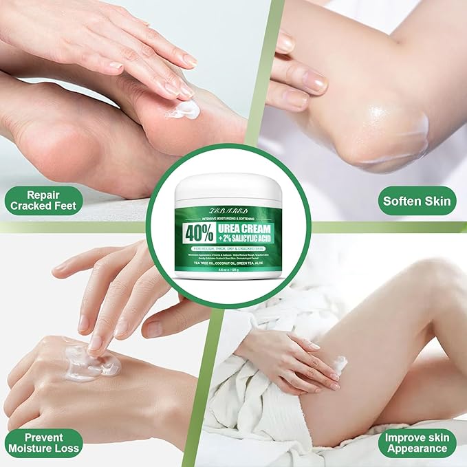 Urea Cream 40 Percent For Feet Maximum Strength, Plus 2% Salicylic Acid with Hyaluronic Acid, Urea Foot & Hand Cream for Dry Cracked, 4.6 oz