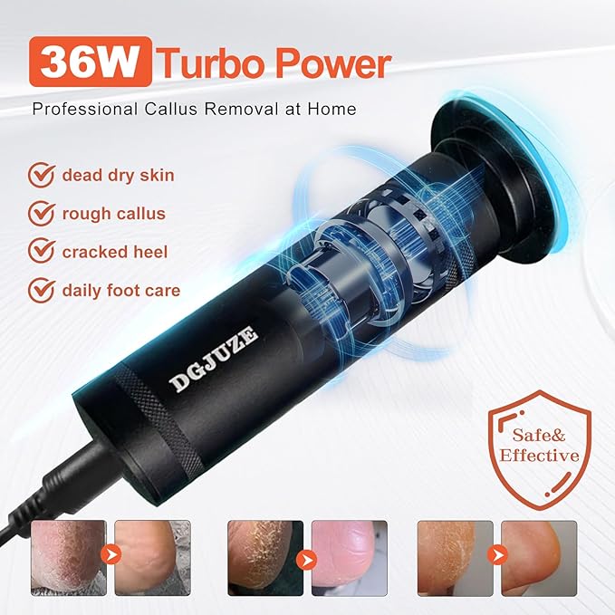 PowerPro Electric Foot Callus Remover,36W Professional 1200rpm Heavy Duty Metal Grinder for Dead Skin Automatic Foot Sander with 60pcs Sandpaper Pads for Home Use Pedicure Kit(Black)