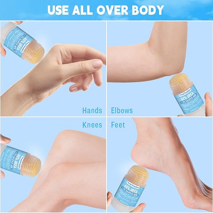2 PCS Urea Cream 60% with 2% Salicylic Acid Foot & Hand Cream Stick - Repair Balm for Cracked Hands, Elbows, Knees, Feet & Heels, Calluses and Exfoliation, Hydrates & Softens Dry Skin, 1.41*2 oz