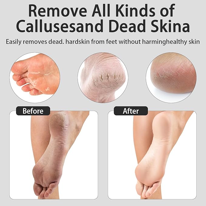 Electric Foot Callus Removers Rechargeable - Electric Foot File with 9 Adjustable Speed, 2 Grinding Heads & 30 Pcs Sandpaper Discs,Professional Foot Sander for Feet Dead Skin and Calluse (Black)