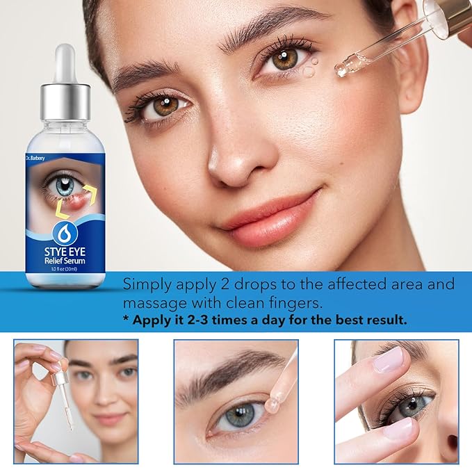 Stye Eye Treatment, Stye Relief Serum, Non-Irritating Formula, Immediatelty Relieve Eye Redness & Swelling, Target Chalazions & Blepharitis (1 Fl. OZ)
