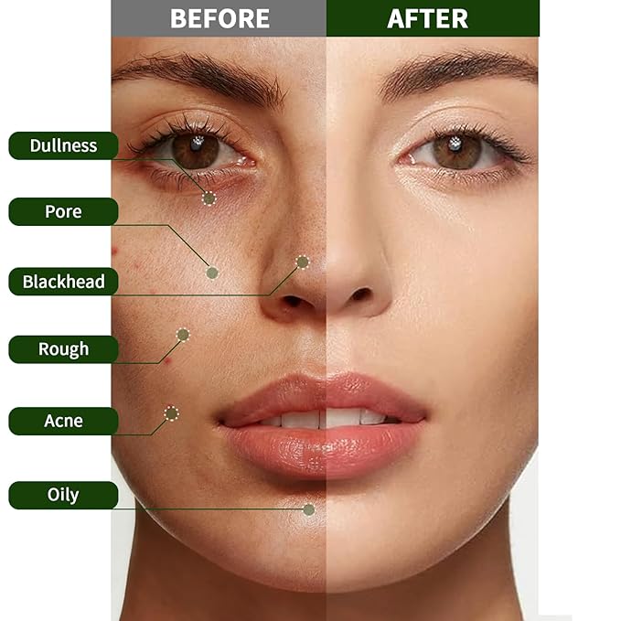 Face Scrub Aloe Vera Exfoliating Gel, Face Exfoliator Peeling Gel Brightening Facial Scrub, Exfoliating Facial Wash Cleanser, Deep Clean Pores, Exfoliate Dirt and Dead Skin for Sensitive Skin, 80g