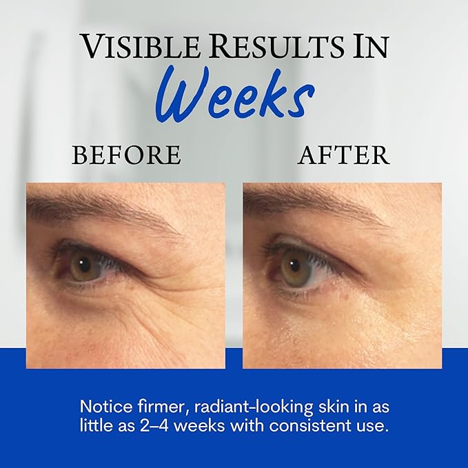 Biologic Sta-Tight Anti Aging Serum – Smoothing Face Serum for Women for Wrinkles and Fine Lines Around Eyes, Mouth & Forehead - Lifting & Firming Formula – 0.5 Fl Oz - Pack of 2