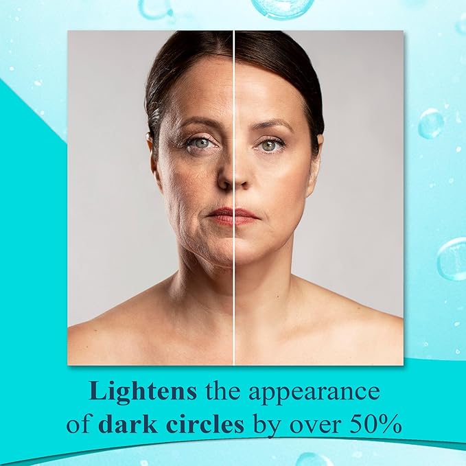 Elite Serum Rx - Anti Aging Under Eye Serum for Dark Circles and Puffiness with 7 Patented Peptides - Extra Strength Eye Lifting and Firming for Wrinkle Repair and Bags Treatment