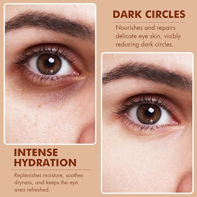 Caffeine Eye Serum + EGCG, Eye Serum for Dark Circles and Puffiness, Under Eye Serum Reduces Puffiness, Dark Circles, Under Eye Bags, Wrinkles and Fine Lines Around The Eyes, Under Eye Serum 30ml