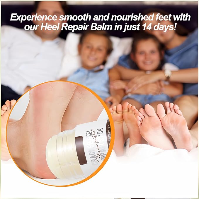 Shea Butter Hydrating Foot Cream, Coconut Nail Softening Hand and Foot Cream Balm Stick, Gentle Soften Heel Balm That Improve Dry Skin for Men Daily Skin Care, 1.41 Oz 1Pc