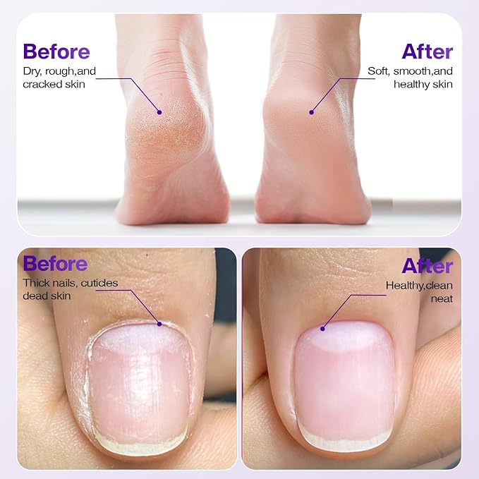 Professional Electric Nail Drill 2000mAH Portable Cordless Electric Nail File 10 in 1 Manicure Pedicure Kit ,5-Speeds Toe Nail Tools Hand Foot Care,Thick Toenail Grinder for Women Men Pets (Purple)