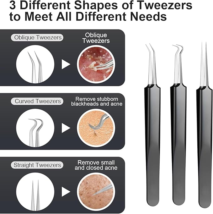 6PCS Blackhead Remover Comedone Extrator Kit, Pimple Extractor Acne Removal Tool Kit, Curved Blackhead Tweezers Kit, Comes with Alcohol Tablets and Magnifying Glasses for Blemish Removal (Iron Box)