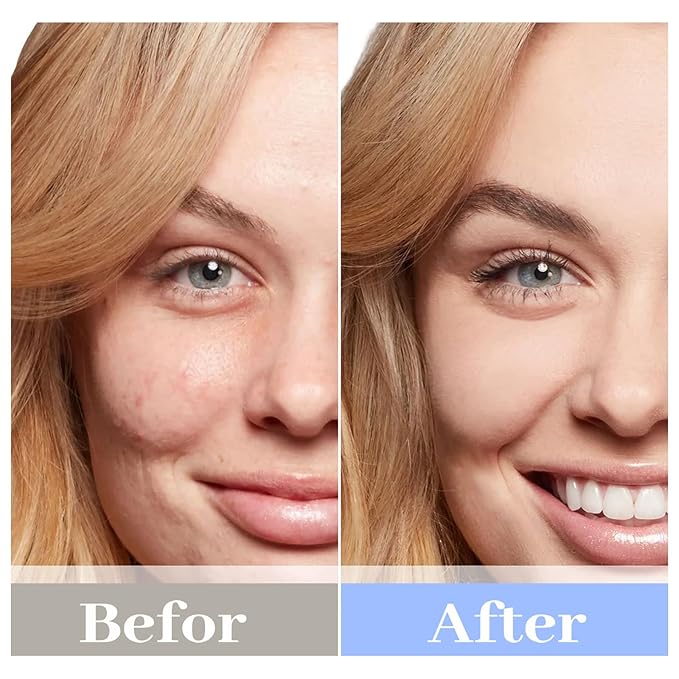 Chlorella Deep Hydrating Mask,with Bio-Collagen,Hyaluronic Acid and Chlorella | Sheet Facial Mask Skincare | Improves Hydrating,Firming,Glowing | Skin moisturizer masks,1count