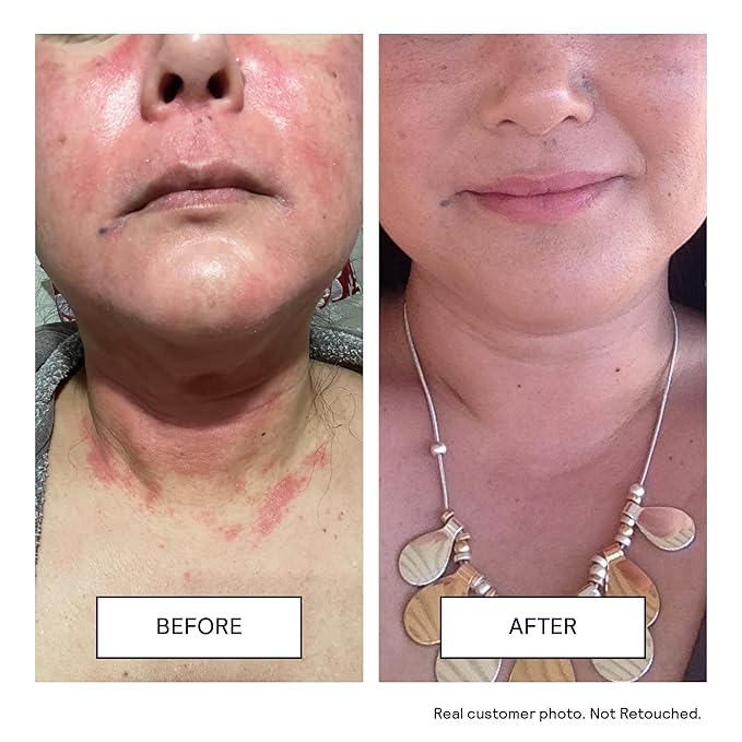 Untoxicated Face Wash - Gentle & Hydrating Face Cleanser for Sensitive Skin - Ceramides, Hyaluronic Acid & Glycerin - No Common Irritants - Non-Foaming - Soap Free - Fragrance Free - 7 Ounce