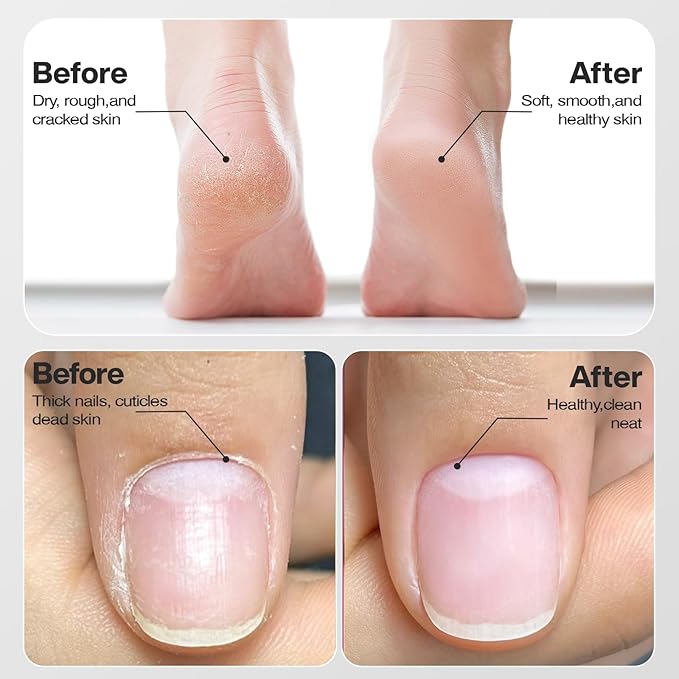 Professional Electric Nail Drill 2000mAH Portable Cordless Electric Nail File 10 in 1 Manicure Pedicure Kit ,5-Speeds Toe Nail Tools Hand Foot Care,Thick Toenail Grinder for Women Men Pets (Silver)