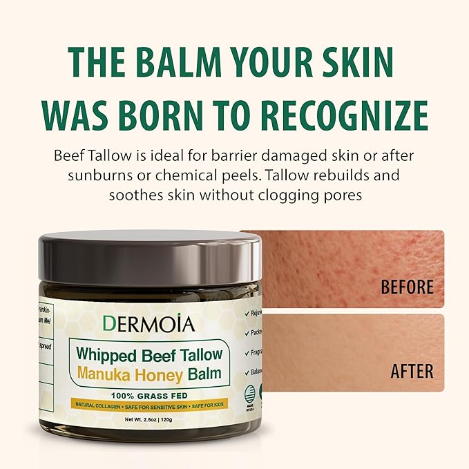 Grass Fed Whipped Beef Tallow for Skin with Manuka Honey - Silky Smooth, Fast Absorbing Tallow & Honey Balm - Ideal for Kids & Eczema Prone Area - Whipped Moisturizer for Dry & Sensitive Skin