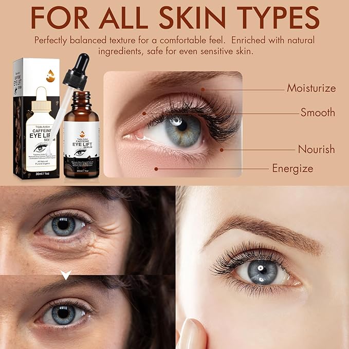 Caffeine Eye Serum + EGCG, Eye Serum for Dark Circles and Puffiness, Under Eye Serum Reduces Puffiness, Dark Circles, Under Eye Bags, Wrinkles and Fine Lines Around The Eyes, Under Eye Serum 30ml