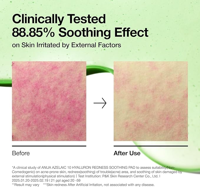 Anua Azelaic 10 Hyaluron Redness Soothing Pad, Troubled & Spot Care with Korean toner pads, Quick & Easy Stretchable Facial Mask with Azelaic acid, Hyaluronic Acid, Korean Skin Care (90 pads)