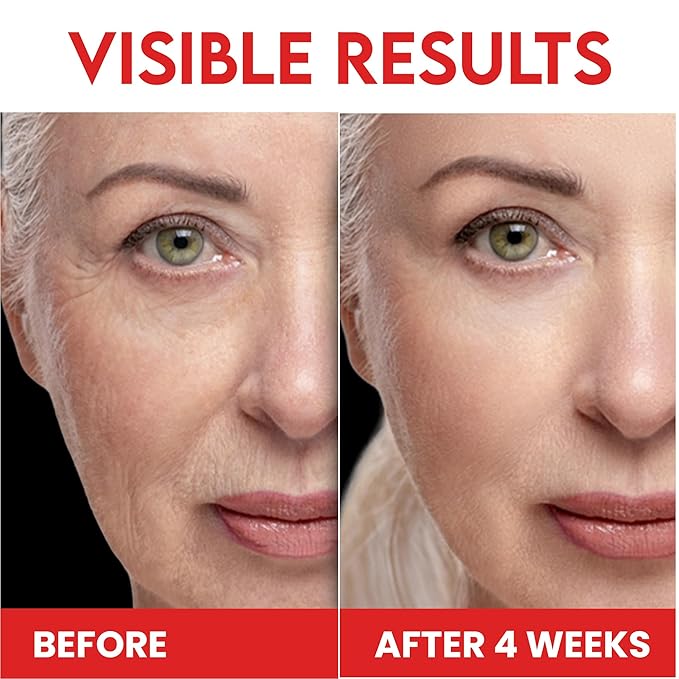 Whipped Tallow Honey Balm – Grass-Fed Beef Tallow infused with Organic Manuka Honey, Rosehip, Jojoba & Olive Oils – Nourishing Face, Neck & Body Lotion, 100% Organic (Frankincense Scent - 2 oz)